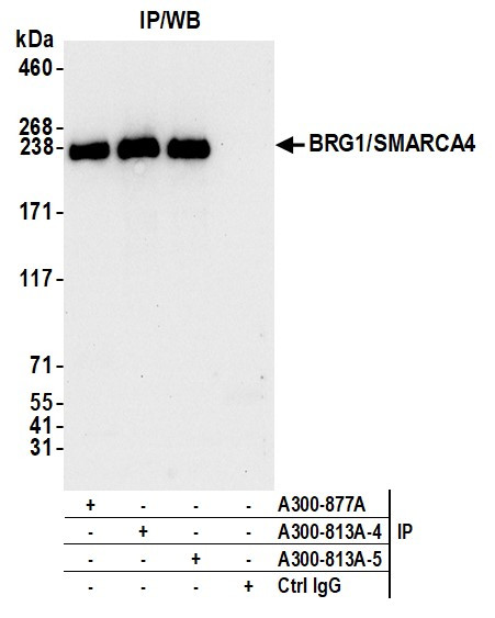 BRG1/SMARCA4 Antibody in Immunoprecipitation (IP)