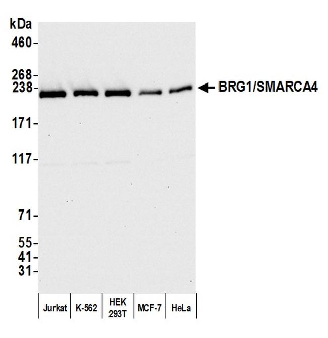 BRG1/SMARCA4 Antibody in Western Blot (WB)