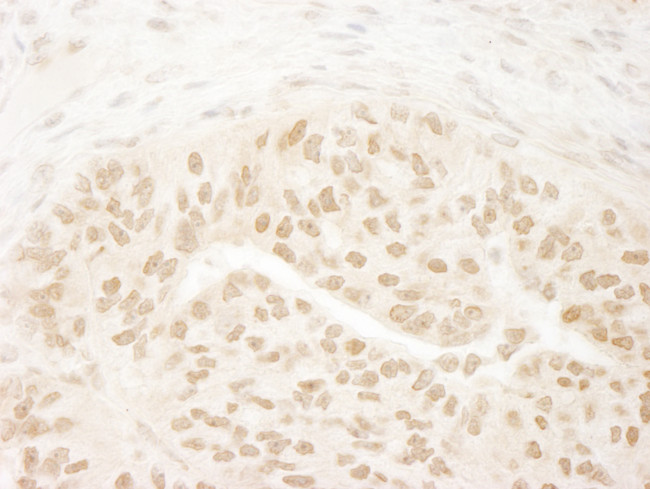 DOT1L Antibody in Immunohistochemistry (Paraffin) (IHC (P))