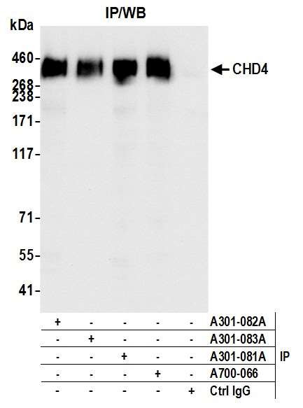 CHD4/Mi2 beta Antibody in Immunoprecipitation (IP)