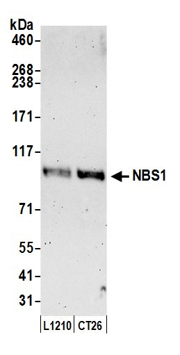 NBS1 Antibody in Western Blot (WB)