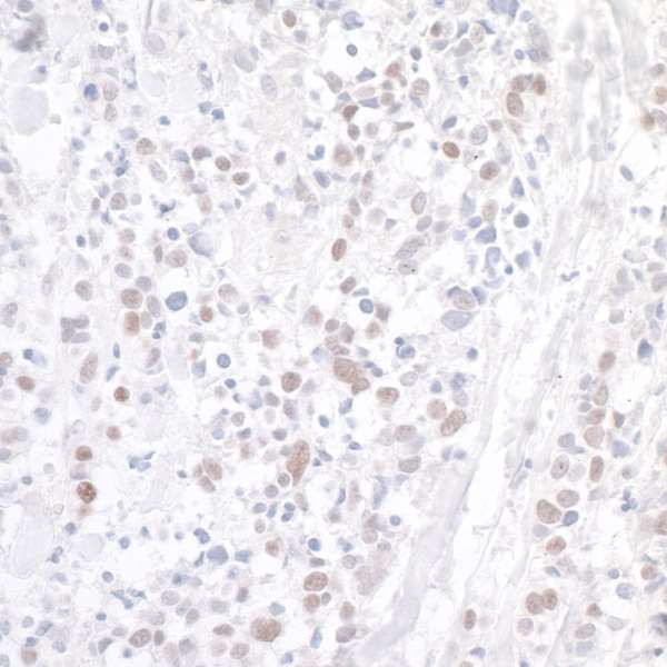 WDR79 Antibody in Immunohistochemistry (Paraffin) (IHC (P))