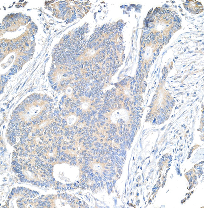 Notch1 Antibody in Immunohistochemistry (Paraffin) (IHC (P))