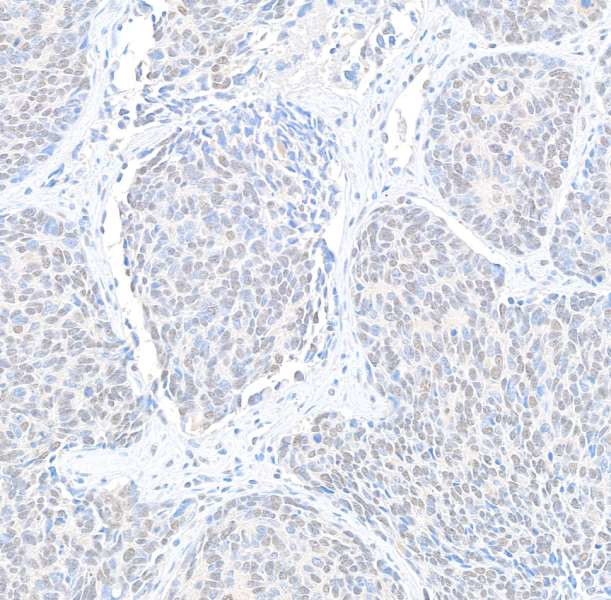 Cyclin K Antibody in Immunohistochemistry (Paraffin) (IHC (P))