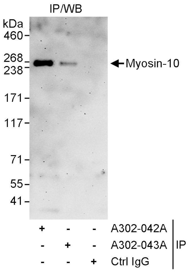 Myosin-10 Antibody in Immunoprecipitation (IP)