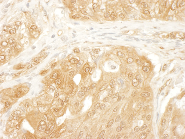 YAP1 Antibody in Immunohistochemistry (Paraffin) (IHC (P))