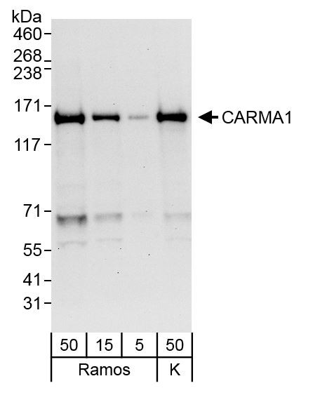 CARMA1 Antibody in Western Blot (WB)