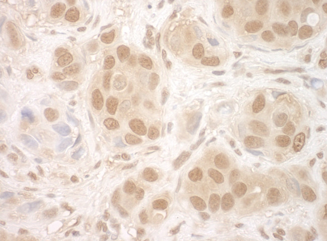 NCBP2 Antibody in Immunohistochemistry (Paraffin) (IHC (P))