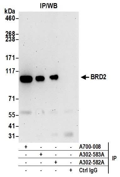 BRD2 Antibody in Immunoprecipitation (IP)