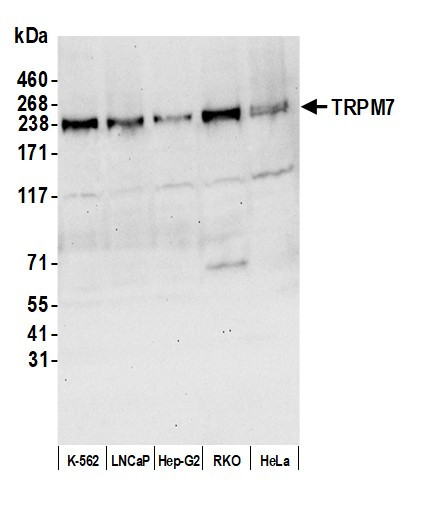 TRPM7 Antibody in Western Blot (WB)