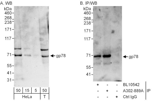 gp78 Antibody in Western Blot (WB)