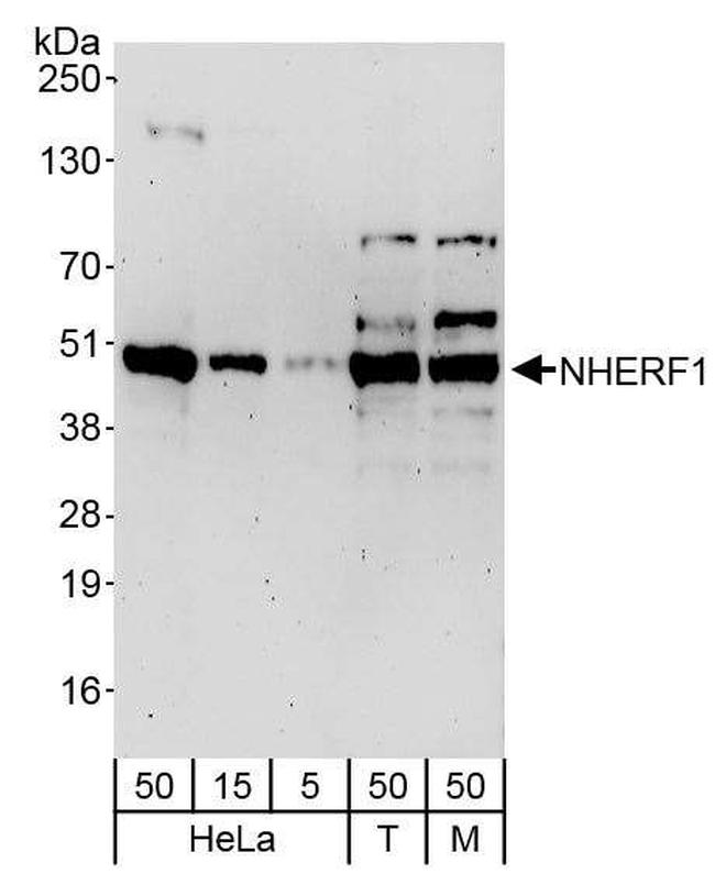 NHERF1 Antibody in Western Blot (WB)