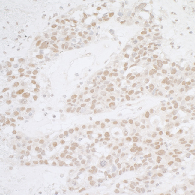 ATF1 Antibody in Immunohistochemistry (Paraffin) (IHC (P))