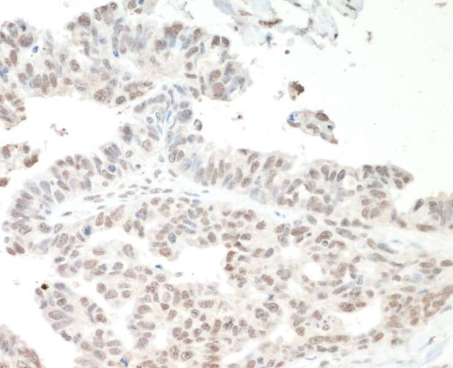 NF110 Antibody in Immunohistochemistry (Paraffin) (IHC (P))