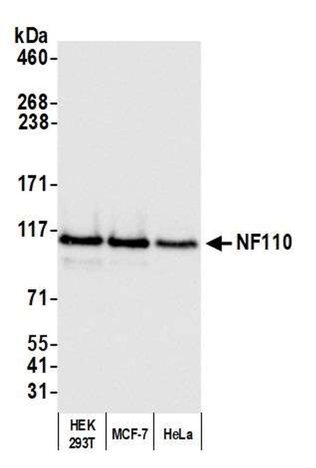 NF110 Antibody in Western Blot (WB)