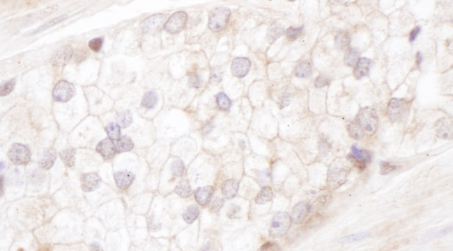 Desmoplakin Antibody in Immunohistochemistry (Paraffin) (IHC (P))