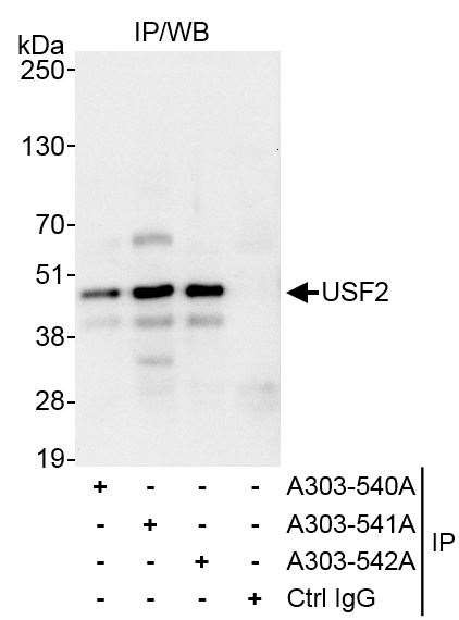 USF2 Antibody in Immunoprecipitation (IP)