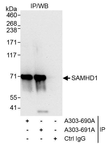 SAMHD1 Antibody in Immunoprecipitation (IP)