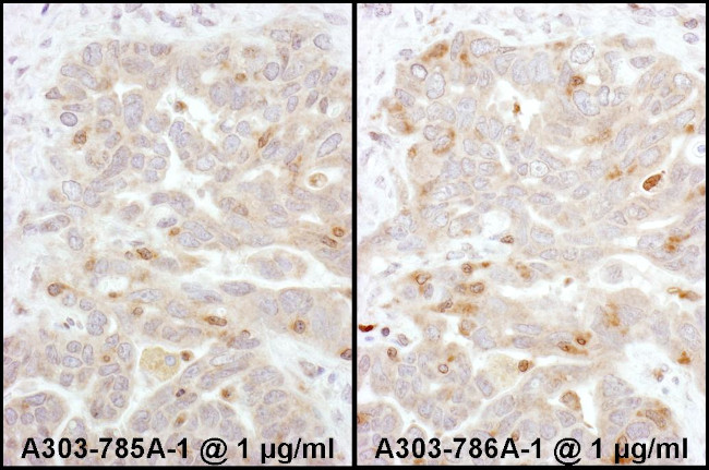 Beta-Arrestin 2 Antibody in Immunohistochemistry (Paraffin) (IHC (P))