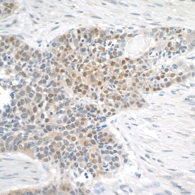 MGEA5 Antibody in Immunohistochemistry (Paraffin) (IHC (P))