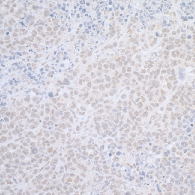 ELAC2 Antibody in Immunohistochemistry (Paraffin) (IHC (P))