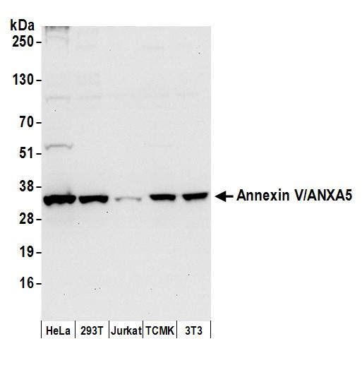 Annexin V/ANXA5 Antibody in Western Blot (WB)