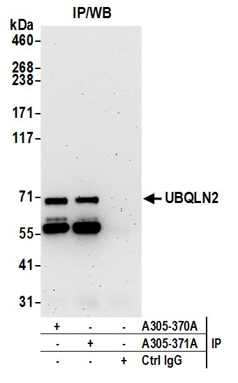 UBQLN2 Antibody in Immunoprecipitation (IP)