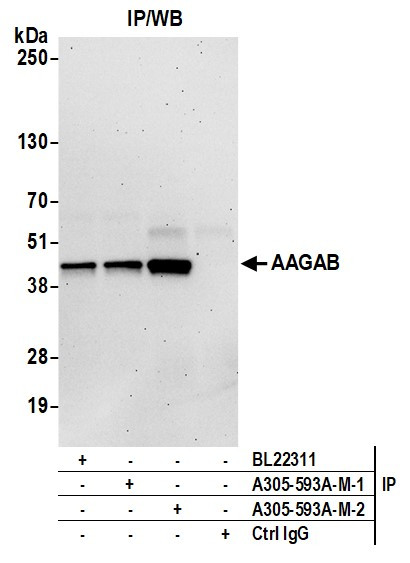AAGAB Antibody in Immunoprecipitation (IP)