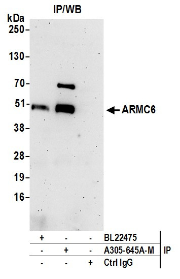 ARMC6 Antibody in Immunoprecipitation (IP)