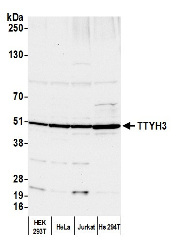 TTYH3 Antibody in Western Blot (WB)