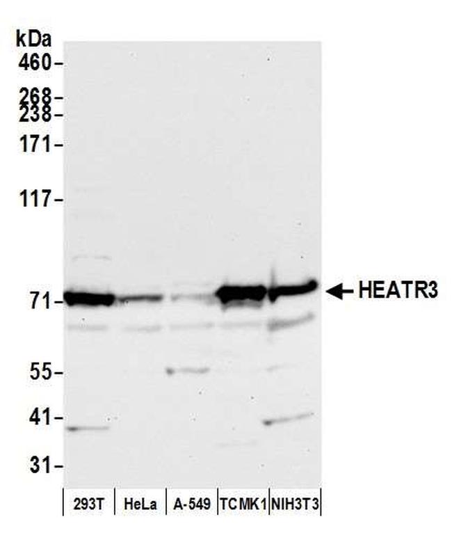 HEATR3 Antibody in Western Blot (WB)