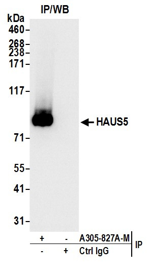 HAUS5 Antibody in Immunoprecipitation (IP)