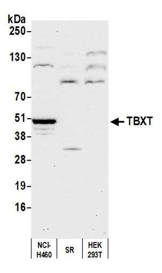 TBXT Antibody in Western Blot (WB)