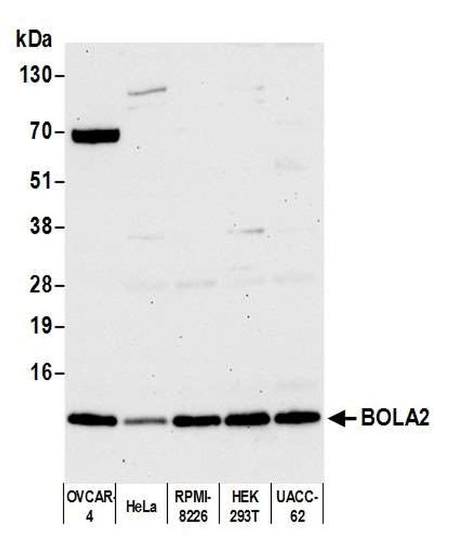 BOLA2 Antibody in Western Blot (WB)