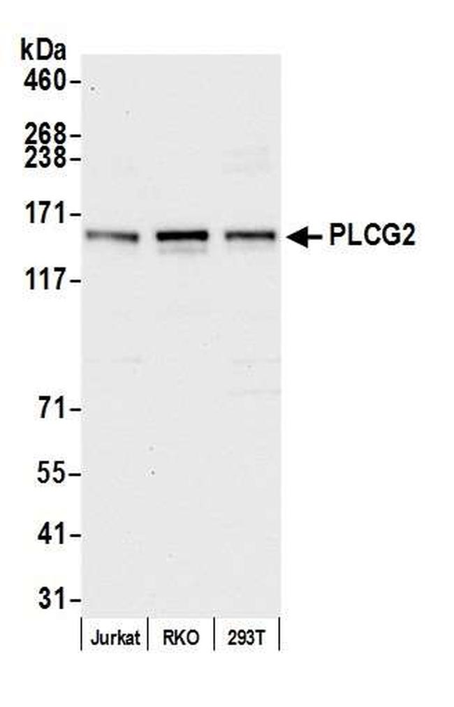 PLCG2 Antibody in Western Blot (WB)