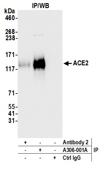 ACE2 Antibody in Immunoprecipitation (IP)