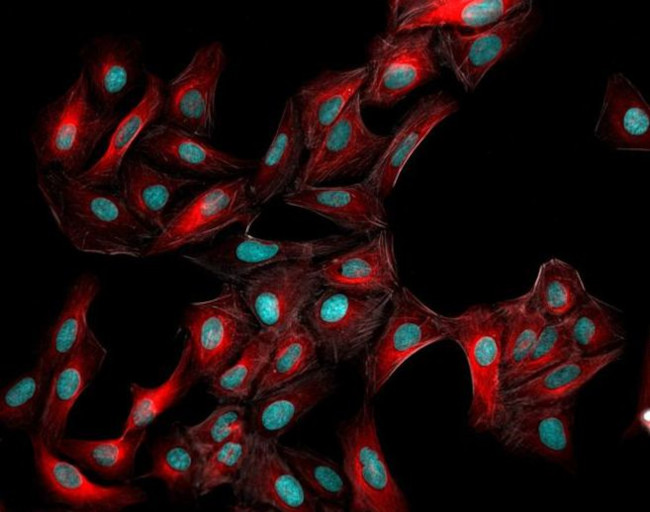 Rabbit IgG (H+L) Highly Cross-Adsorbed Secondary Antibody in Immunocytochemistry (ICC/IF)