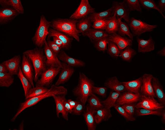 Rabbit IgG (H+L) Highly Cross-Adsorbed Secondary Antibody in Immunocytochemistry (ICC/IF)