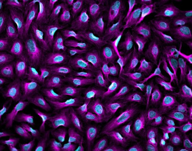 Mouse IgG (H+L) Highly Cross-Adsorbed Secondary Antibody in Immunocytochemistry (ICC/IF)