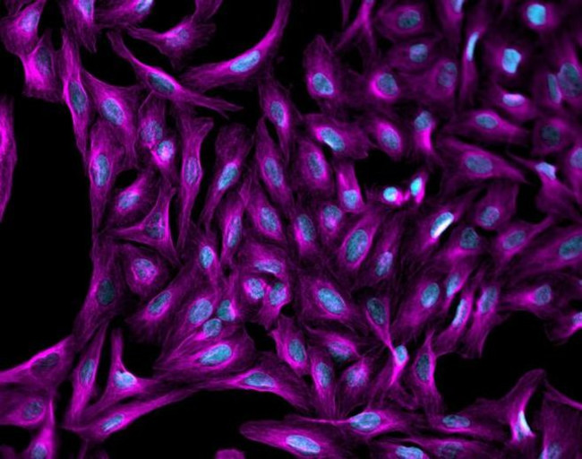 Mouse IgG (H+L) Highly Cross-Adsorbed Secondary Antibody in Immunocytochemistry (ICC/IF)