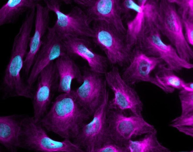 Mouse IgG (H+L) Highly Cross-Adsorbed Secondary Antibody in Immunocytochemistry (ICC/IF)