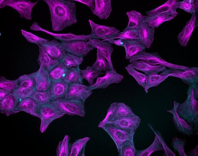 Mouse IgG (H+L) Highly Cross-Adsorbed Secondary Antibody in Immunocytochemistry (ICC/IF)