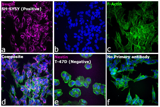 Mouse IgG (H+L) Highly Cross-Adsorbed Secondary Antibody in Immunocytochemistry (ICC/IF)