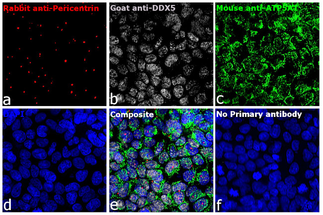 Mouse IgG (H+L) Highly Cross-Adsorbed Secondary Antibody in Immunocytochemistry (ICC/IF)