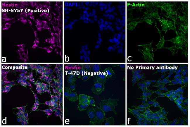 Mouse IgG (H+L) Highly Cross-Adsorbed Secondary Antibody in Immunocytochemistry (ICC/IF)