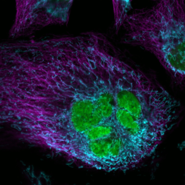 Mouse IgG (H+L) Highly Cross-Adsorbed Secondary Antibody in Immunocytochemistry (ICC/IF)