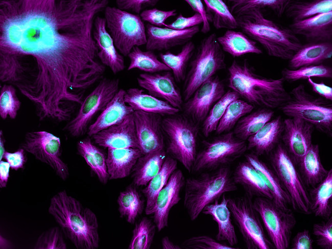 Rat IgG (H+L) Highly Cross-Adsorbed Secondary Antibody in Immunocytochemistry (ICC/IF)