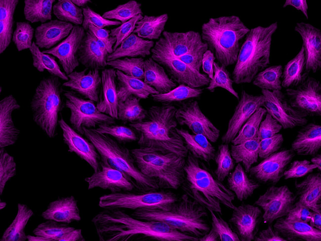 Rat IgG (H+L) Highly Cross-Adsorbed Secondary Antibody in Immunocytochemistry (ICC/IF)