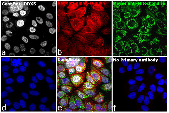 Rat IgG (H+L) Highly Cross-Adsorbed Secondary Antibody in Immunocytochemistry (ICC/IF)