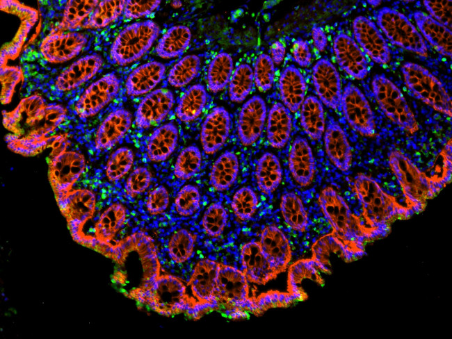 Mouse IgG (H+L) Cross-Adsorbed Secondary Antibody in Immunohistochemistry (Paraffin) (IHC (P))